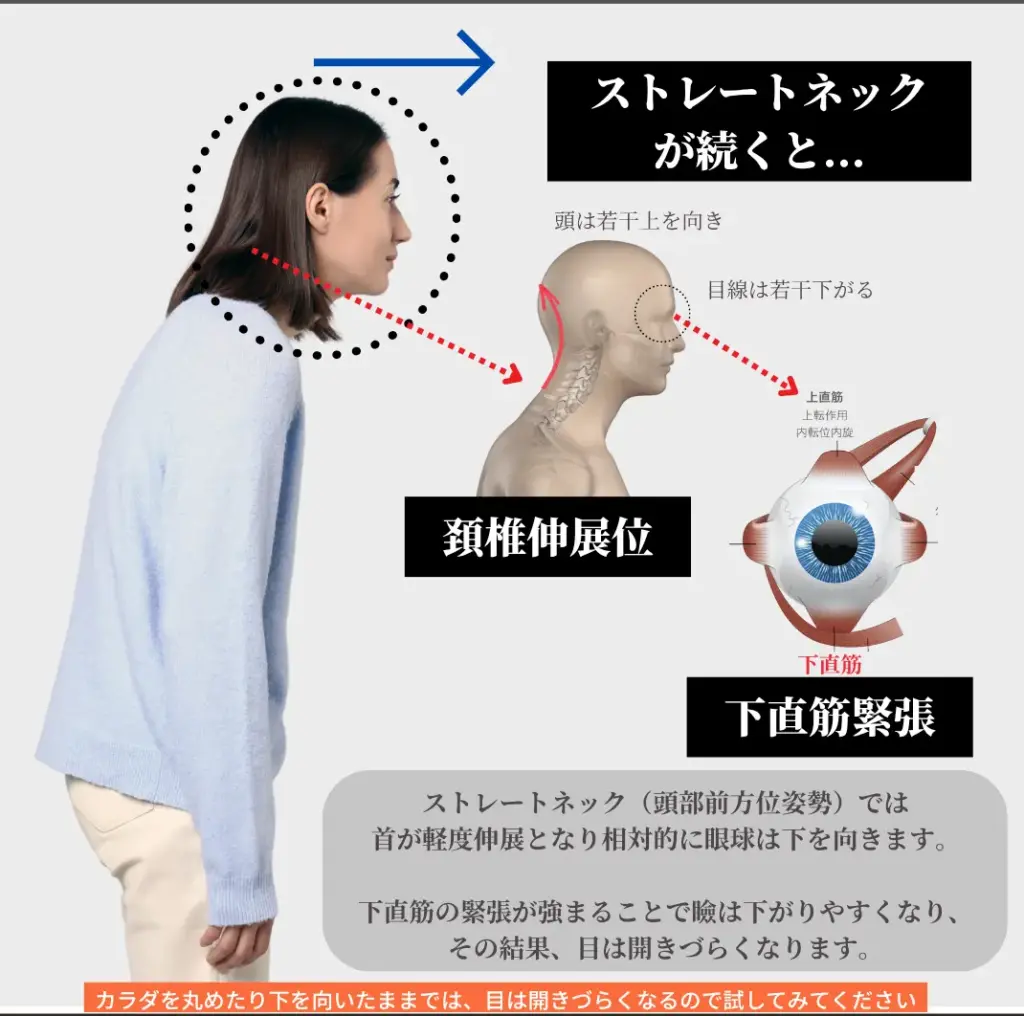 不良姿勢と目のたるみ・サイズの関連
