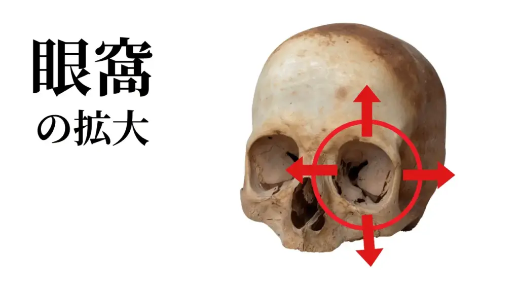 頭蓋骨の変化：眼窩