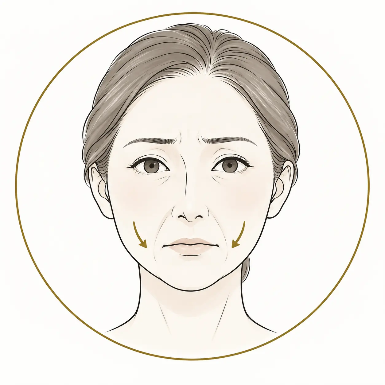 たるみやほうれい線の悩みを表したイラスト