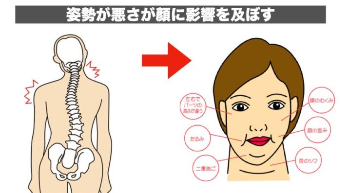 顔の歪みの原因：姿勢・骨盤の歪み